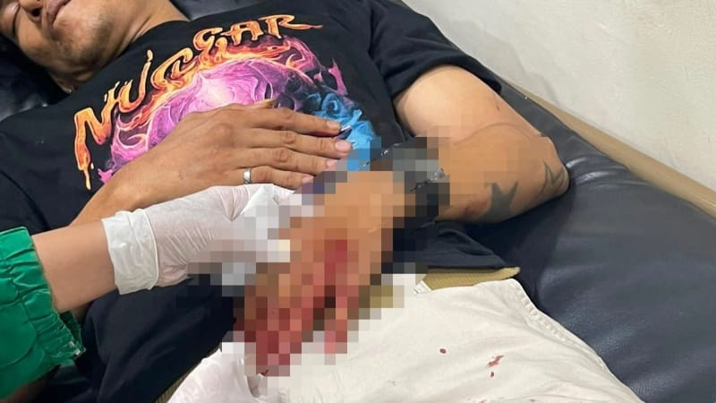 Police Arrest Suspect in Severe Assault Case at Hotel Kundur Parking Area in Batam